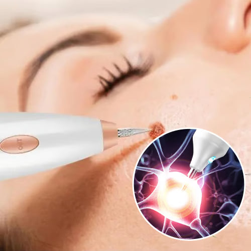 SkinClear Pro – Removedor de Verrugas, Pecas y Manchas por Plasma Láser