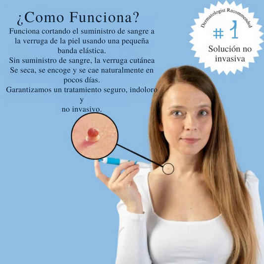 Kit MyPeau™ Eliminador de Verrugas - ¡No más marcas en la piel! + E-Book GRATIS 🎁